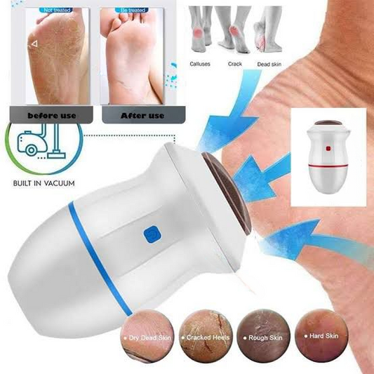 Electric Foot Callus Remover