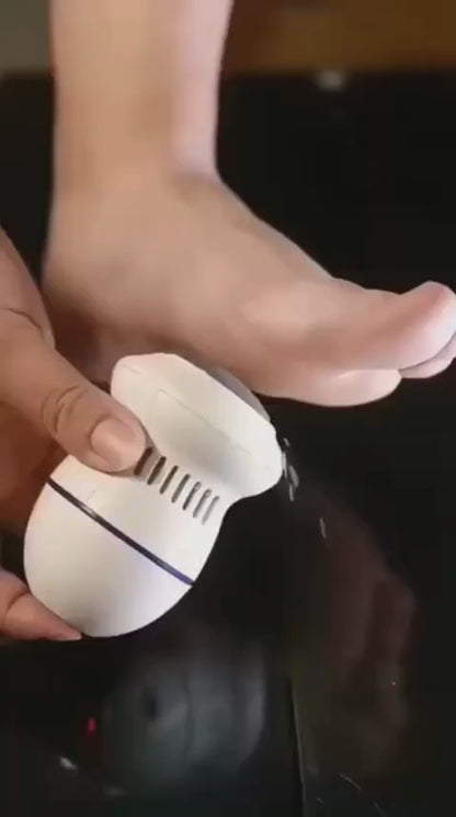 Electric Foot Callus Remover